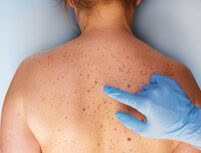 Skin cancer screening and treatments Cutting Edge Plastic Surgery, Pukekohe