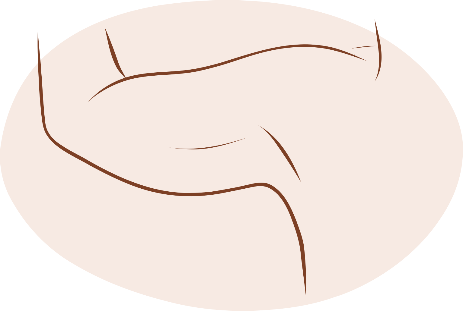 Brachioplasty-pic