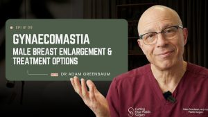Gynaecomastia