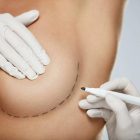breast-left